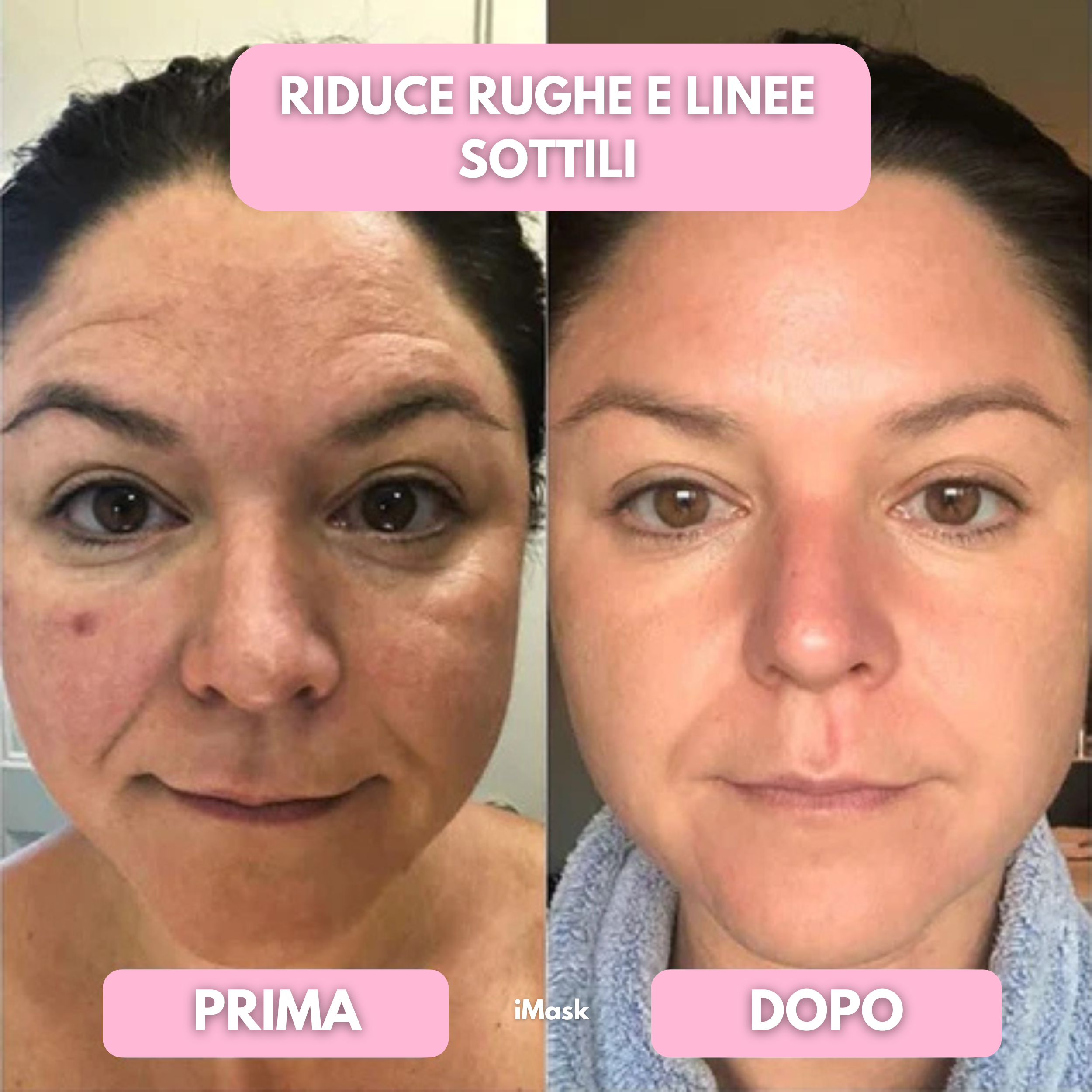 Maschera al bio-collagene iMask